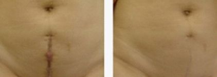 深圳私密整形醫(yī)院哪家好？讓我們來為您推薦最佳選擇