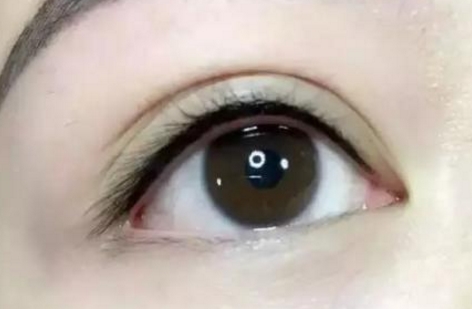 馬桂娥面頰填充脂肪能打造自然輪廓，挺陽高效！醫(yī)生背景介紹必讀！