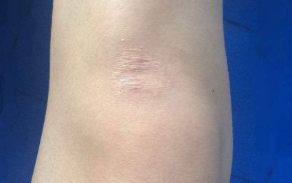 ?？诔暼パ鄞罴堰x擇有哪些？評價最好的醫(yī)療機構大揭秘！