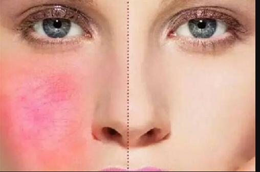 李朕整形醫(yī)生的綜合評價和服務(wù)優(yōu)勢