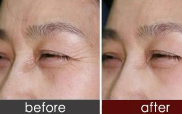 上海肋骨鼻哪位專家技術過硬？人氣牛仔鼻醫(yī)生排名大曝光！