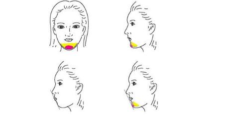 王大太的鼻子整形效果怎么樣？醫(yī)生是哪里的？技術(shù)水平如何？坐診醫(yī)院及當(dāng)?shù)貓?bào)價(jià)揭秘