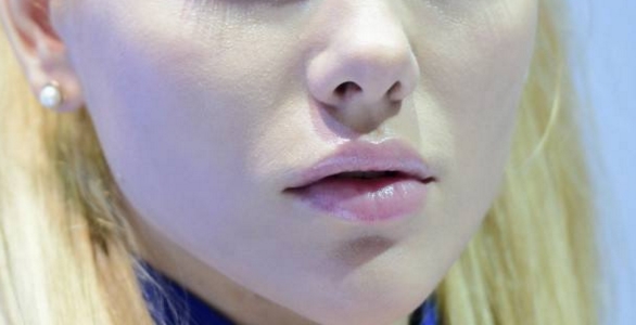 2023成都胸部下垂嚴(yán)重整形專家排行榜前十(鞏永強(qiáng)、田秋梅、李川名單口碑怎么樣)