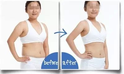 2023成都抽脂隆胸整形上榜清單前十名專家(秦曉、鄧兵、賈映缽價(jià)格不貴口碑好)