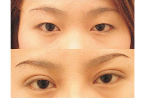 2023合肥水動力吸脂瘦肚子10強醫(yī)生(朱德剛、孫洋、徐泓實力口碑滿分！)