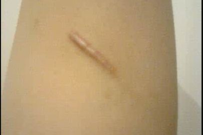 濟(jì)寧哪家做假體隆胸好？揭秘濟(jì)寧最受歡迎的假體隆胸醫(yī)院！