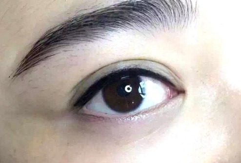 北京歐爾美姚杰娜的個(gè)人隱私揭曉，激光祛斑全程詳解