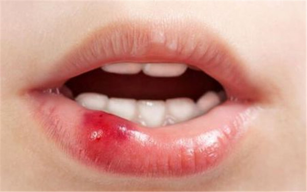 2023南京冷凍溶脂瘦后背專家排行榜前幾(董欣、郝超、朱臺航口碑技術(shù)令人稱贊)