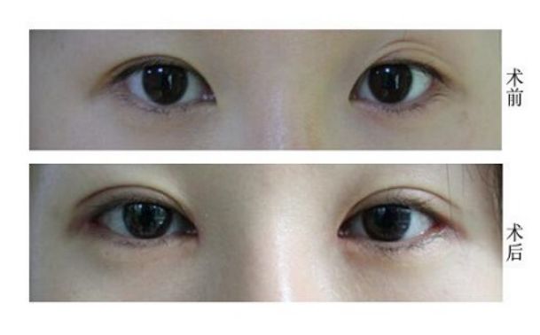 天津修復唇腭裂的醫(yī)院哪家好？專業(yè)解讀！