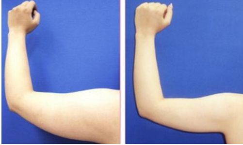 重慶整形美容醫(yī)院哪家好？最權(quán)威的整形美容醫(yī)院盤點(diǎn)