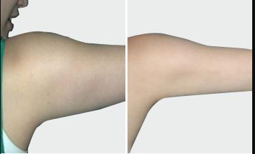 上海中國(guó)去疤痕醫(yī)院哪家好？高效去除疤痕的專業(yè)醫(yī)院推薦