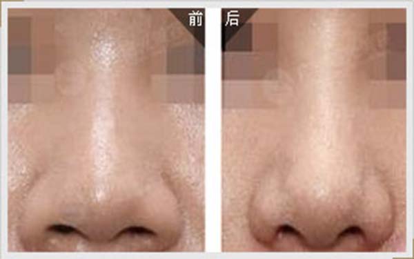 2023濟南私密年輕化正規(guī)醫(yī)生口碑十強(王召東、王鳳英、王禛禛醫(yī)美TOP遍布一線城市)