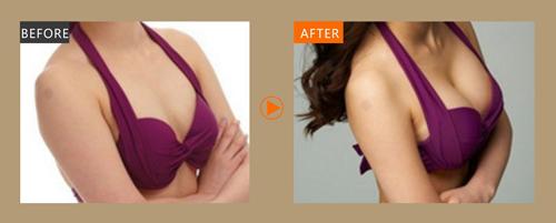 2023青島唇紋射頻去除榜單十強(qiáng)醫(yī)生(崔容碩、趙娟、袁家德快來看看這些醫(yī)生)