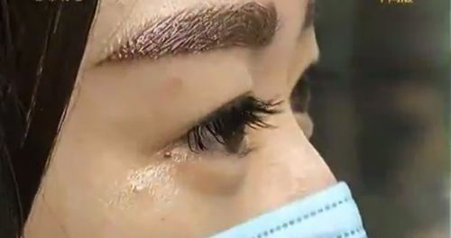 武漢招風(fēng)耳矯正哪家好？尋找專業(yè)耳部矯正專家的最佳選擇