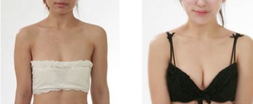 大連市做雙眼皮哪家好？了解大連市雙眼皮手術(shù)的費(fèi)用、效果和口碑