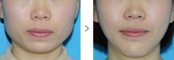 深圳哪家去色斑醫(yī)院好？專家推薦這些知名醫(yī)療機(jī)構(gòu)