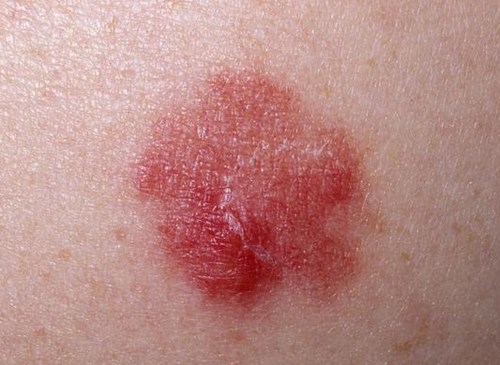 北京鼻修復(fù)醫(yī)生評(píng)價(jià)：劉彥軍、薛軼群技術(shù)對(duì)比，附價(jià)格一覽