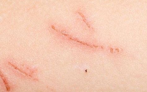 南陽市拉皮除皺手術(shù)哪家好？選擇何種醫(yī)院更安心？