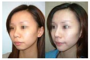 秦皇島美容美體哪家好？刷爆朋友圈的秘密美容院大揭秘！