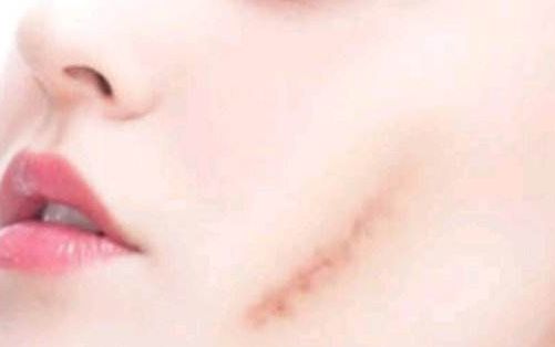 濰坊哪家醫(yī)院做抽脂整形好，服務好口碑好？