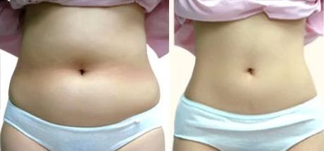 上海哪家醫(yī)院做美容手術好？——選擇上海做美容手術醫(yī)院的首選方案