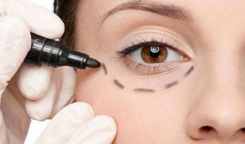 深圳分體式隱形隆鼻醫(yī)院十強(qiáng)榜單揭曉！