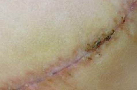 重慶去斑好的醫(yī)院哪家好？權(quán)威推薦，告訴您重慶著名的去斑治療醫(yī)院!