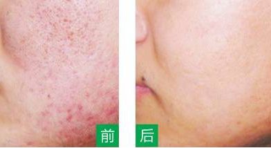 永州美辰醫(yī)療整形醫(yī)院的價(jià)格如何？收費(fèi)標(biāo)準(zhǔn)透明公開，術(shù)前注意事項(xiàng)必看！