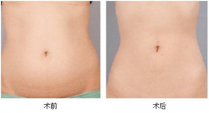 2023東莞激光磨皮除皺推薦十強(qiáng)專家(王麗沙、朱曉梅、黃雙聞入圍的都是當(dāng)?shù)蒯t(yī)美領(lǐng)頭羊)