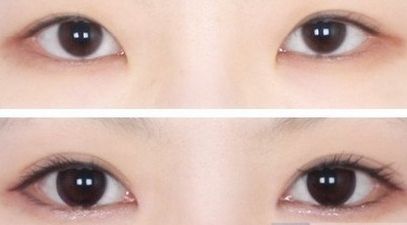 ?？谧雎”轻t(yī)院哪家好？?？谀募艺葆t(yī)院的鼻部整形效果好且口碑贊？