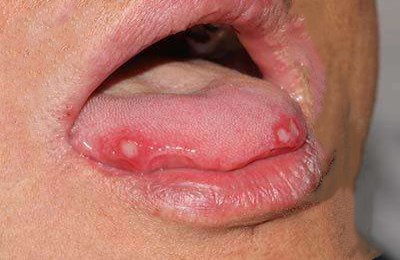 2023六安玻尿酸填充眼角皺紋專家前10位上榜名單(趙遵江、李成虎、夏利娟千萬別錯過！)