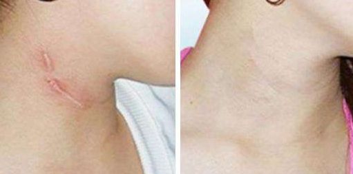 南京整形醫(yī)院哪家好又實惠？全面評估南京整容手術(shù)價格與口碑