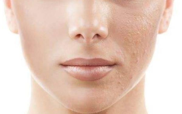 上海柴云做雙眼皮修復是否靠譜？體驗如何？