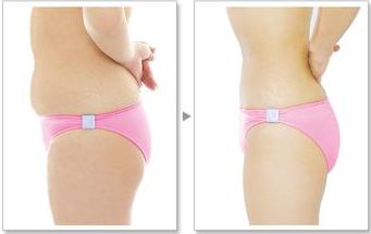 您在武漢協(xié)和醫(yī)院可以找到熱瑪吉嗎？預(yù)約技術(shù)嫻熟的醫(yī)生，口碑非常好！