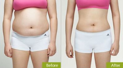 合肥祛眼袋，如何選擇最適合的醫(yī)院？