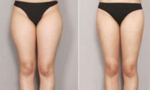 合肥祛痘效果最好的醫(yī)療美容機構(gòu)有哪些？