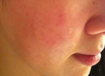 揭秘鄭州五位頗具盛名的鼻子專家，治療技術(shù)獨(dú)具匠心，深受人們推崇！