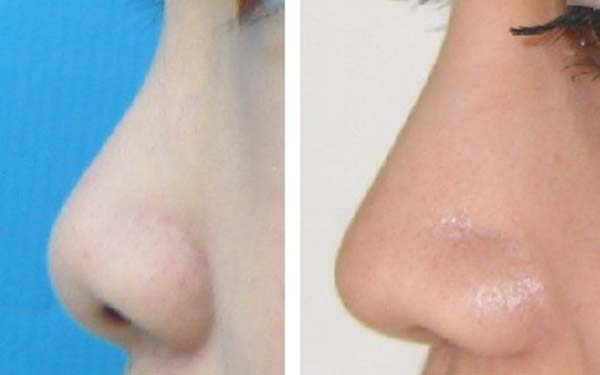 2023珠海眼上魚尾紋專家排行榜前10(李洪生、劉彤、池鉉淑醫(yī)生大咖口碑推薦)