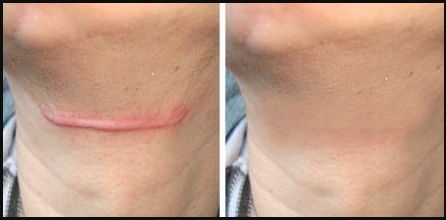 南京哪家私密醫(yī)院做得最好？來一探究竟！