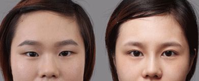 合肥哪家處女膜修復醫(yī)院靠譜又專業(yè)？