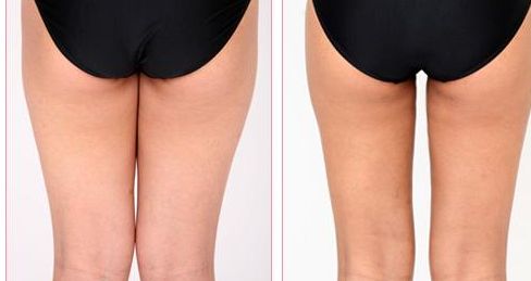 桂林私立醫(yī)院推薦，哪家好？2023最新排名解析