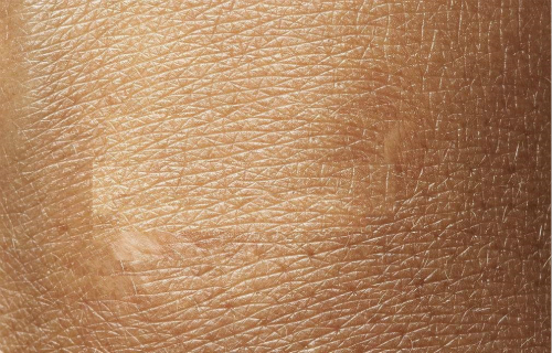 2023懷化溶脂去生長紋醫(yī)生口碑榜前十(李雪梅、史萍、張春喜收藏不踩雷)