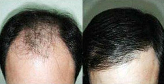 大連去狐臭哪家醫(yī)院效果好，專家推薦的醫(yī)院有哪些？