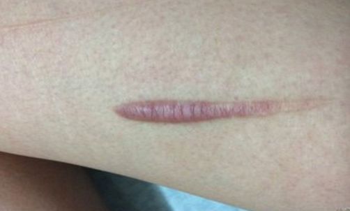 【2023年揚州雙眼皮正規(guī)醫(yī)院排行榜公布！最靠譜的哪家好？】