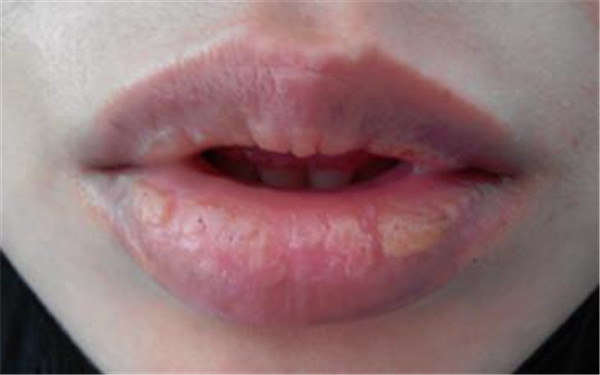 2023深圳狼毒斑推薦TOP10強(qiáng)專家(邱斌、姚成紅、戴琛華斬獲榜首~)