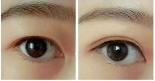 南昌做隆胸手術(shù)哪家好？選南昌最受歡迎的隆胸手術(shù)醫(yī)院有哪些