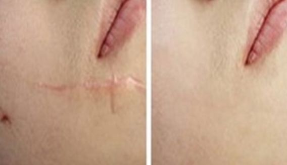 上海有哪些整形醫(yī)院值得推薦呢？