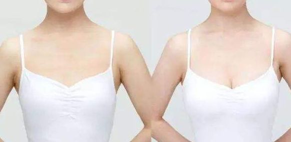 威海假體豐胸醫(yī)院哪家好？從專家口碑、手術效果看威海頂級醫(yī)院推薦！