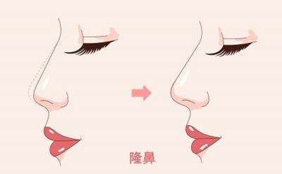 2023重慶膠原蛋白填充面部強(qiáng)榜前10名的專家(陳鵬、楊藝、蔣思軍這幾家技術(shù)高超價(jià)格低)