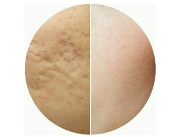 臺(tái)州薇閣醫(yī)療美容效果好嗎？李坤醫(yī)生簡(jiǎn)介、評(píng)價(jià)、位置一探究竟